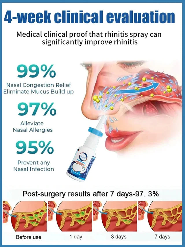 【100% Effective】Medical Nasal Spray