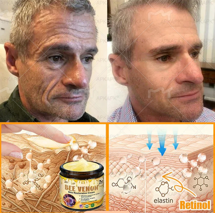 Made and Shipped from USA ✨𝖡𝖾𝖾 𝗏𝖾𝗇𝗈𝗆 𝖲𝗄𝗂𝗇 𝖱𝖾𝗌𝗍𝗈𝗋𝖺𝗍𝗂𝗈𝗇 𝖢𝗋𝖾𝖺𝗆