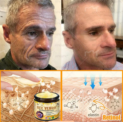 Made and Shipped from USA ✨𝖡𝖾𝖾 𝗏𝖾𝗇𝗈𝗆 𝖲𝗄𝗂𝗇 𝖱𝖾𝗌𝗍𝗈𝗋𝖺𝗍𝗂𝗈𝗇 𝖢𝗋𝖾𝖺𝗆