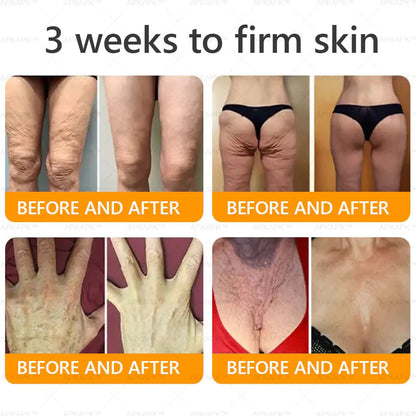 Made and Shipped from USA ✨𝖡𝖾𝖾 𝗏𝖾𝗇𝗈𝗆 𝖲𝗄𝗂𝗇 𝖱𝖾𝗌𝗍𝗈𝗋𝖺𝗍𝗂𝗈𝗇 𝖢𝗋𝖾𝖺𝗆