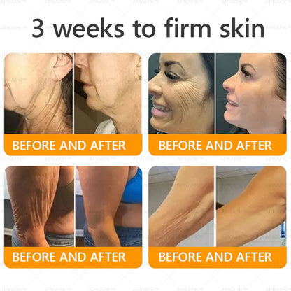 Made and Shipped from USA ✨𝖡𝖾𝖾 𝗏𝖾𝗇𝗈𝗆 𝖲𝗄𝗂𝗇 𝖱𝖾𝗌𝗍𝗈𝗋𝖺𝗍𝗂𝗈𝗇 𝖢𝗋𝖾𝖺𝗆