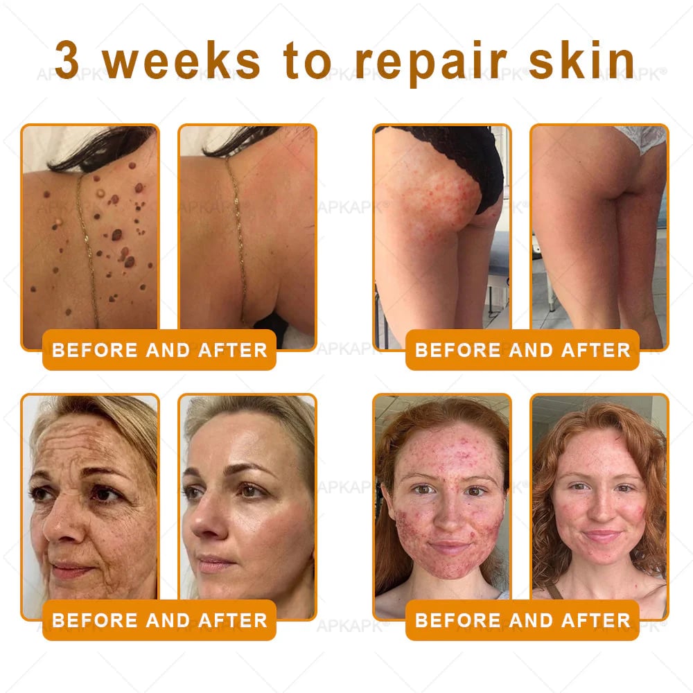 Made and Shipped from USA ✨𝖡𝖾𝖾 𝗏𝖾𝗇𝗈𝗆 𝖲𝗄𝗂𝗇 𝖱𝖾𝗌𝗍𝗈𝗋𝖺𝗍𝗂𝗈𝗇 𝖢𝗋𝖾𝖺𝗆