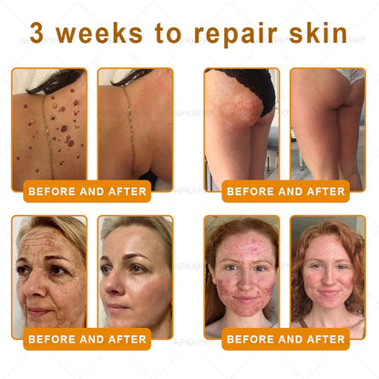 Made and Shipped from USA ✨𝖡𝖾𝖾 𝗏𝖾𝗇𝗈𝗆 𝖲𝗄𝗂𝗇 𝖱𝖾𝗌𝗍𝗈𝗋𝖺𝗍𝗂𝗈𝗇 𝖢𝗋𝖾𝖺𝗆