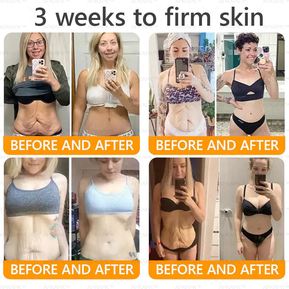 Made and Shipped from USA ✨𝖡𝖾𝖾 𝗏𝖾𝗇𝗈𝗆 𝖲𝗄𝗂𝗇 𝖱𝖾𝗌𝗍𝗈𝗋𝖺𝗍𝗂𝗈𝗇 𝖢𝗋𝖾𝖺𝗆