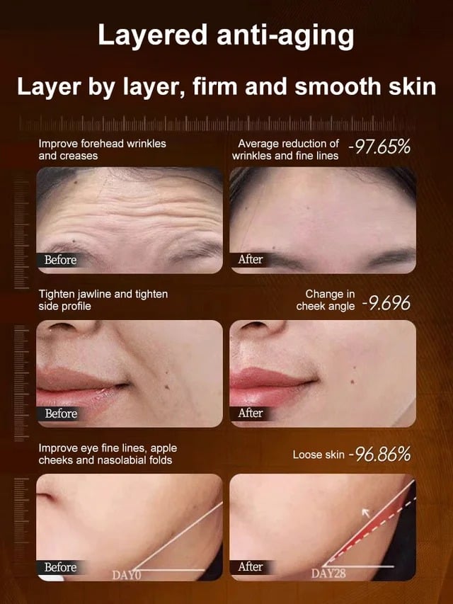 [One Touch To Remove Wrinkles]Micro-Molecular Collagen Anti-Wrinkle Lotion