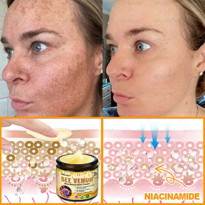 Made and Shipped from USA ✨𝖡𝖾𝖾 𝗏𝖾𝗇𝗈𝗆 𝖲𝗄𝗂𝗇 𝖱𝖾𝗌𝗍𝗈𝗋𝖺𝗍𝗂𝗈𝗇 𝖢𝗋𝖾𝖺𝗆