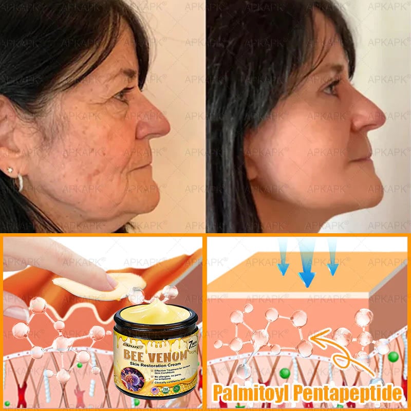 Made and Shipped from USA ✨𝖡𝖾𝖾 𝗏𝖾𝗇𝗈𝗆 𝖲𝗄𝗂𝗇 𝖱𝖾𝗌𝗍𝗈𝗋𝖺𝗍𝗂𝗈𝗇 𝖢𝗋𝖾𝖺𝗆