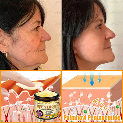 Made and Shipped from USA ✨𝖡𝖾𝖾 𝗏𝖾𝗇𝗈𝗆 𝖲𝗄𝗂𝗇 𝖱𝖾𝗌𝗍𝗈𝗋𝖺𝗍𝗂𝗈𝗇 𝖢𝗋𝖾𝖺𝗆