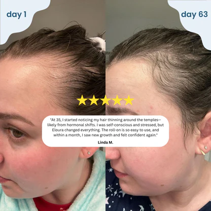 Eloura Hair Growth SerumRoI