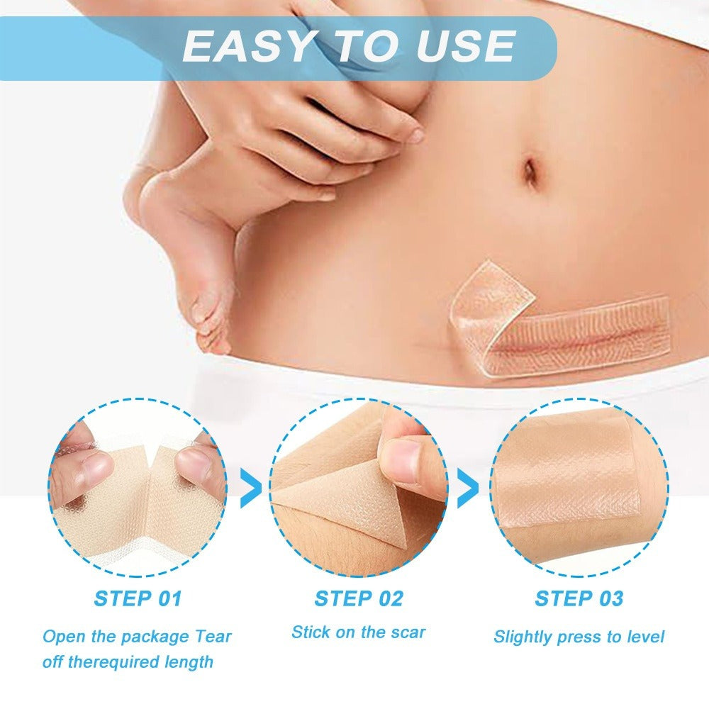 Silicone Gel Scar Relief Patch Csection