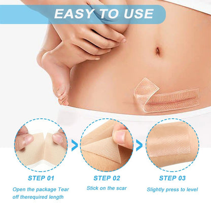 Silicone Gel Scar Relief Patch Csection