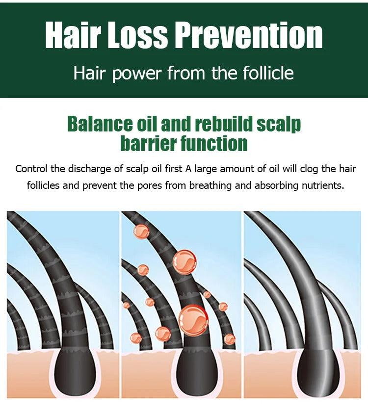 Hair Growth Essence Treatment Spray