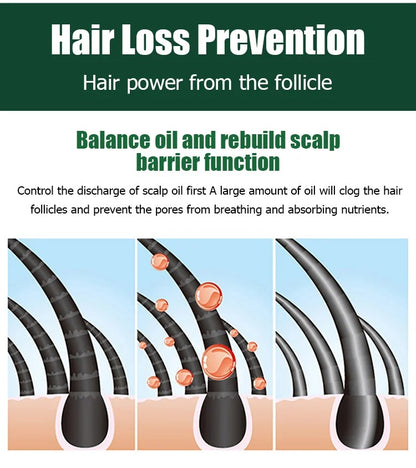 Hair Growth Essence Treatment Spray