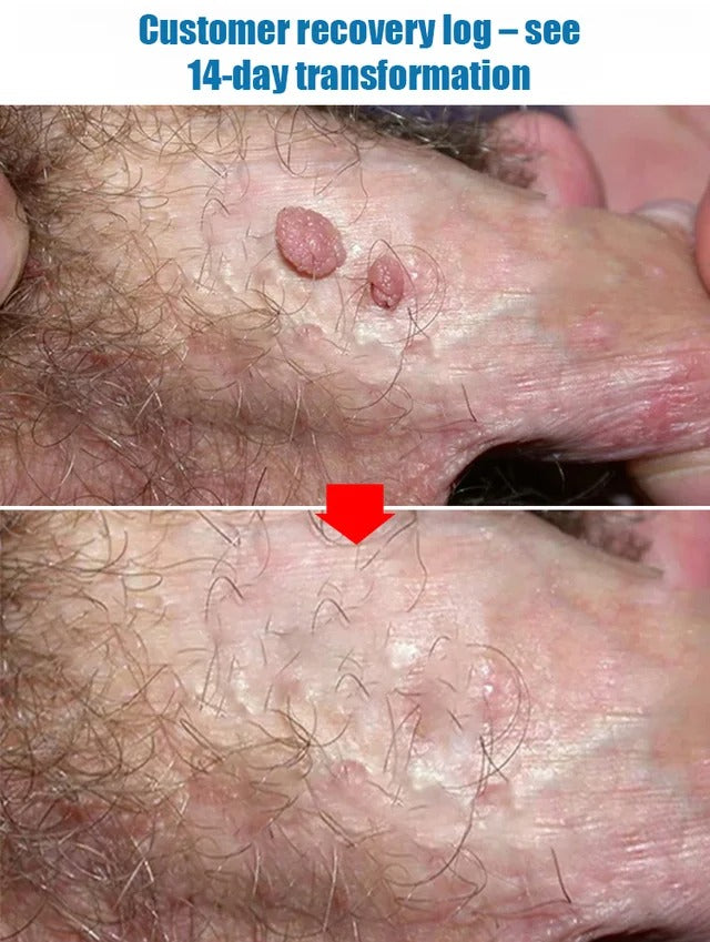 Men's Body Blemish Care Cream